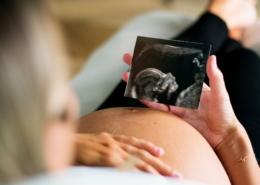 A pregnant person looks at their ultrasound photo while relaxing in their home.