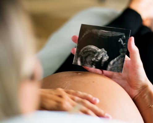 A pregnant person looks at their ultrasound photo while relaxing in their home.