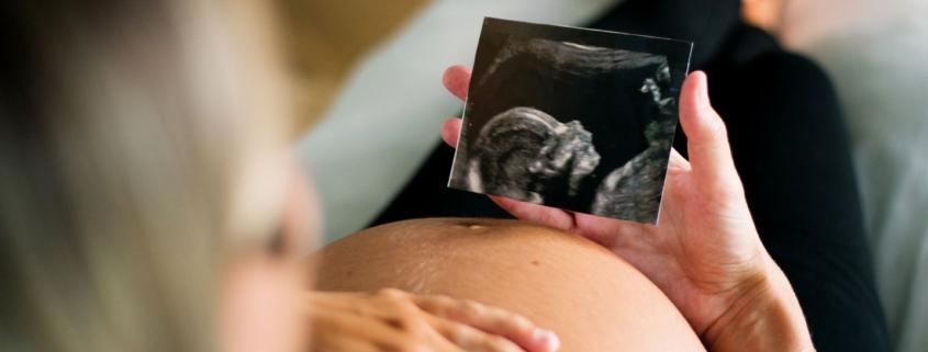 A pregnant person looks at their ultrasound photo while relaxing in their home.